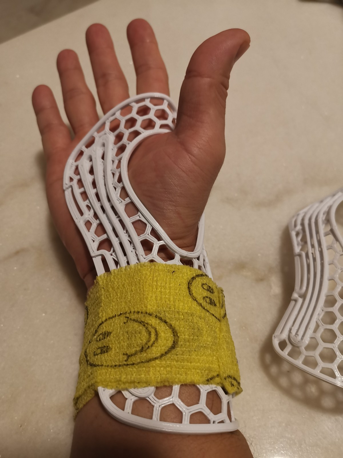 3D Printed Wrist Brace