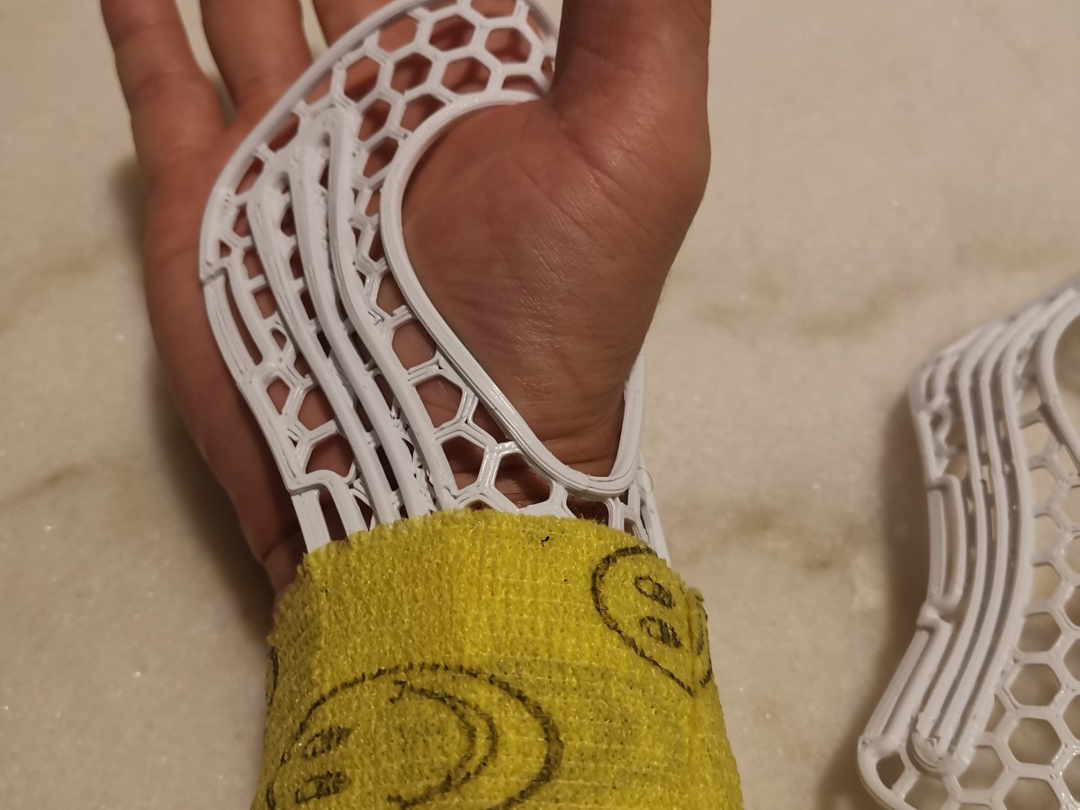 3D Printed Wrist&nbsp;Brace